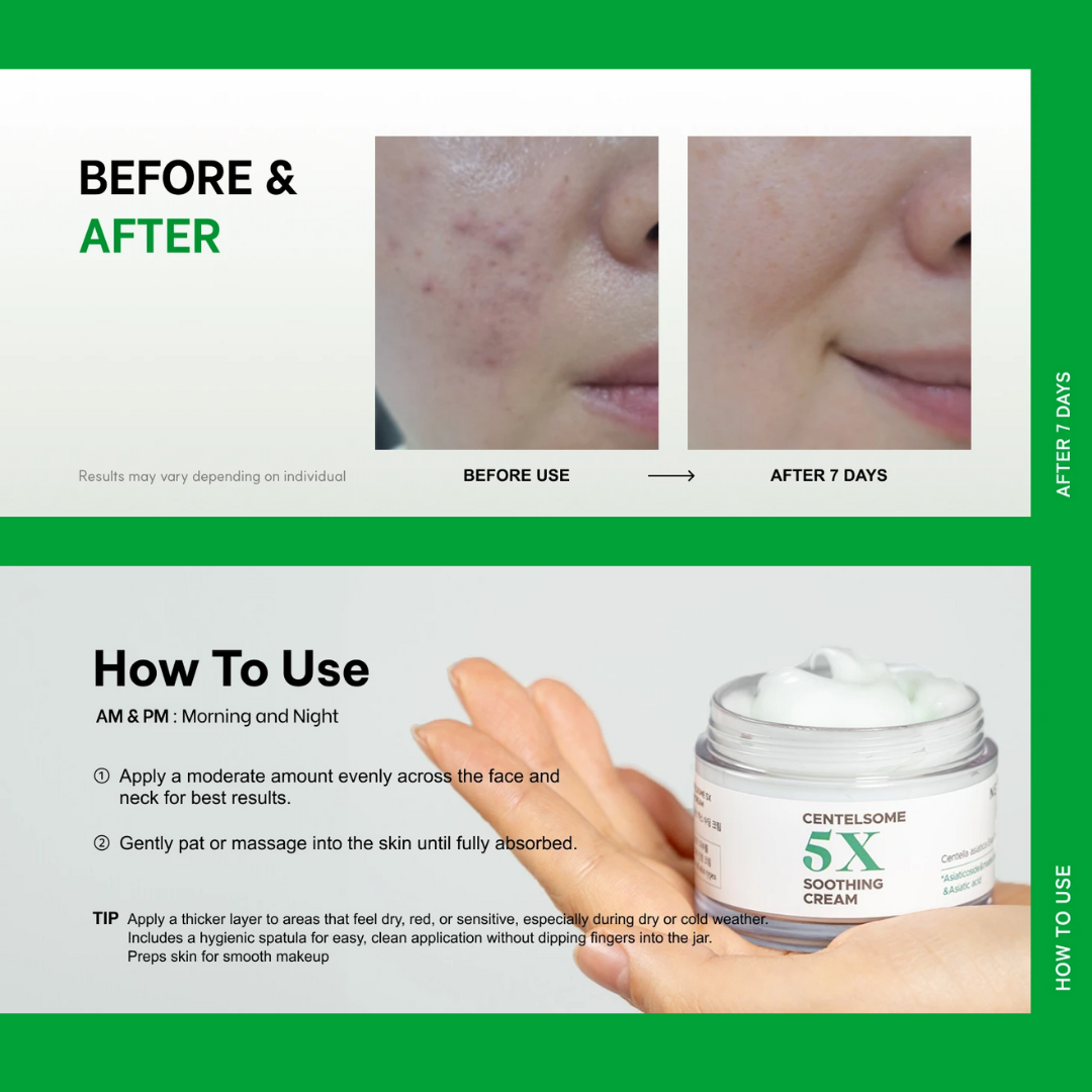 Centella Asiatica Moisturizer Cream 50ml Korean Skincare Face Lotion Ceramide Moisture 5X Soothing Exosome