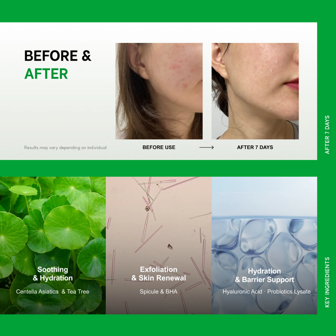 Spicule Cica Foam Cleanser 100ml Korean Face Wash for Acne Prone Skin Care