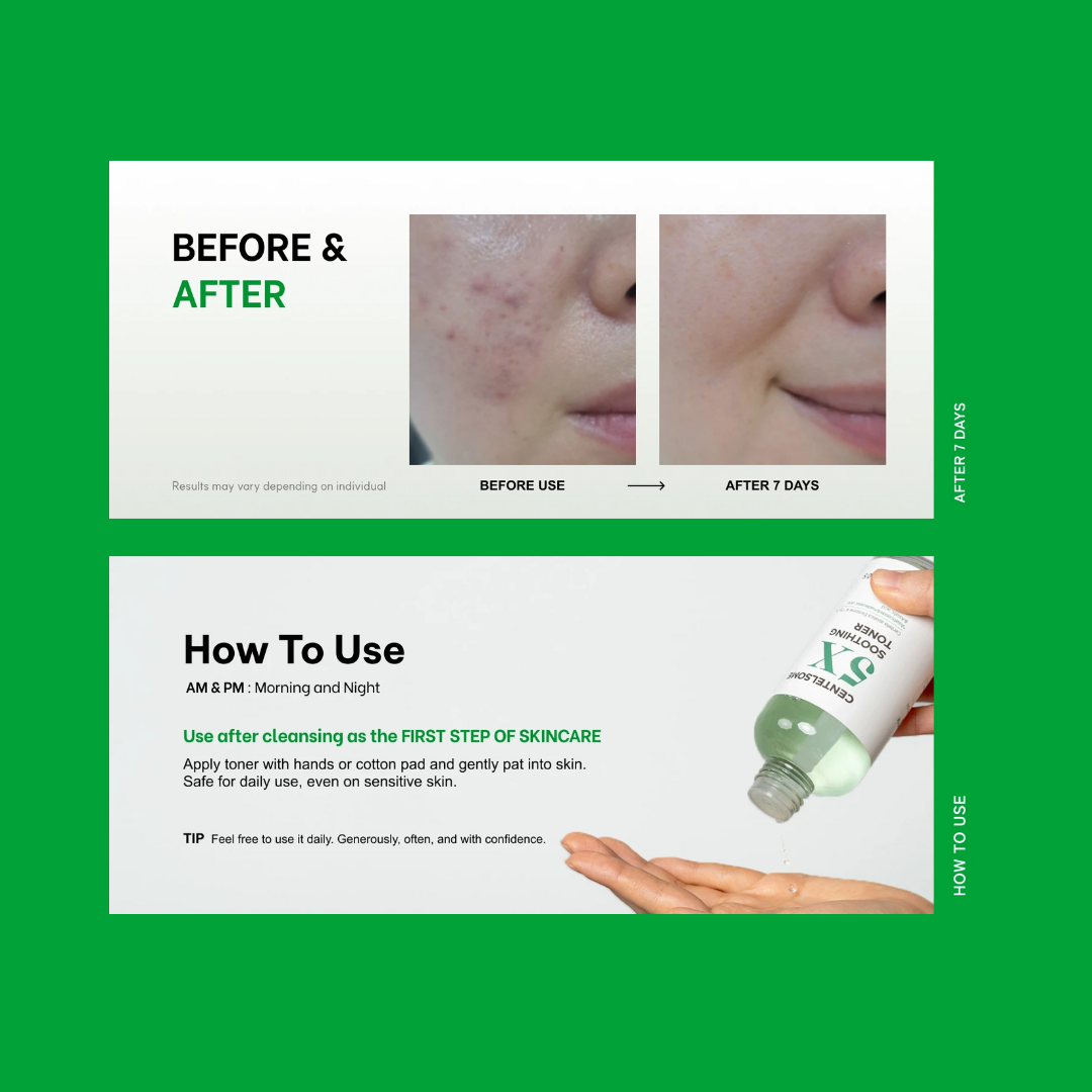 Centella Exosome 5X Soothing Toner 200ml Green Tea Facial Toner Dermatologist-Tested for Sensitive