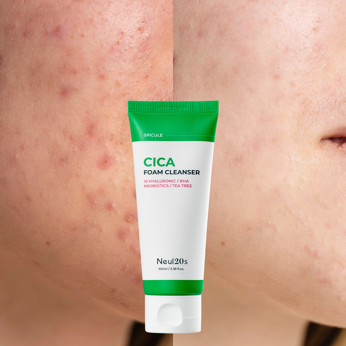 Spicule Cica Foam Cleanser 100ml Korean Face Wash for Acne Prone Skin Care