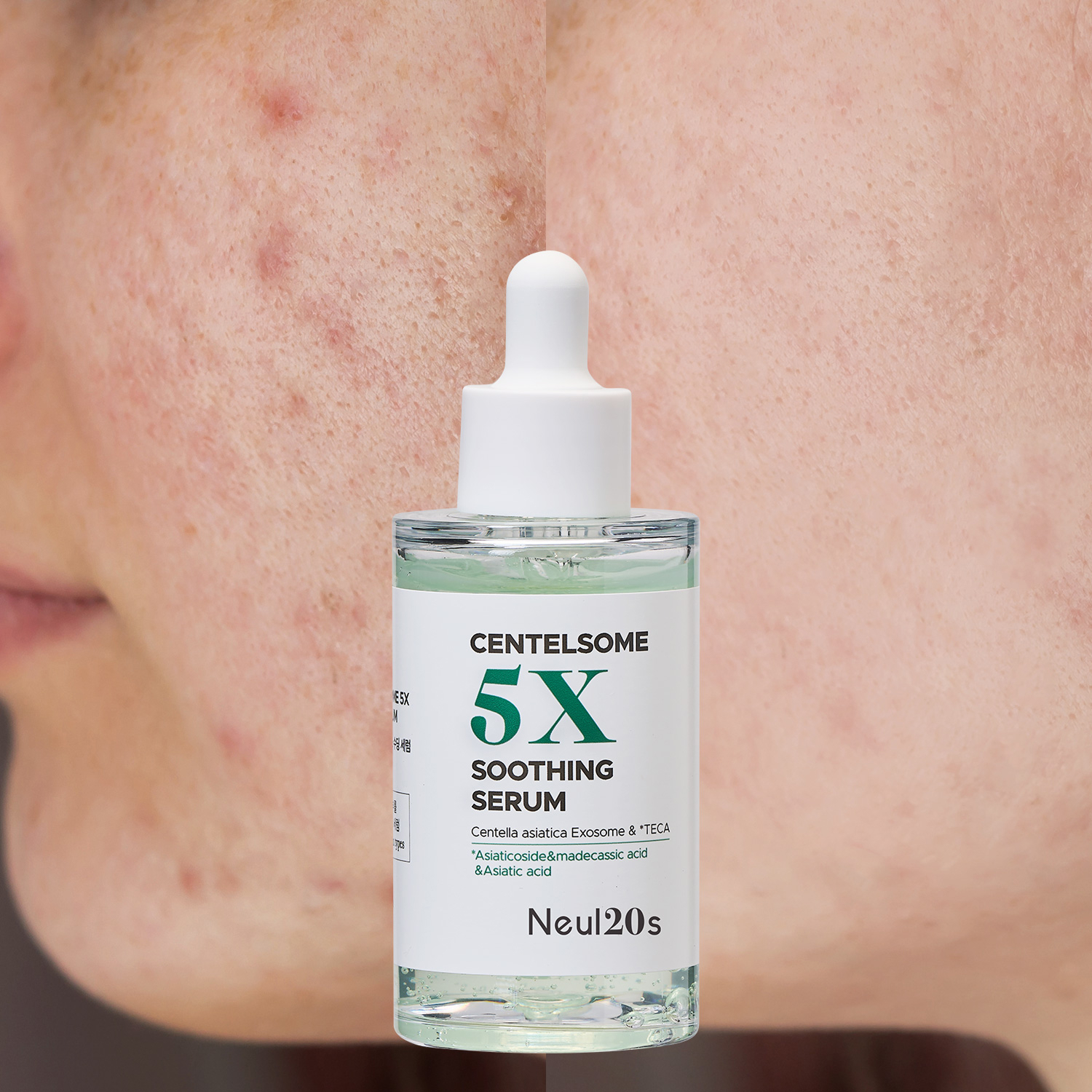 Centelsome 5X Soothing Serum 50ml Anti-Aging Acne Treatment