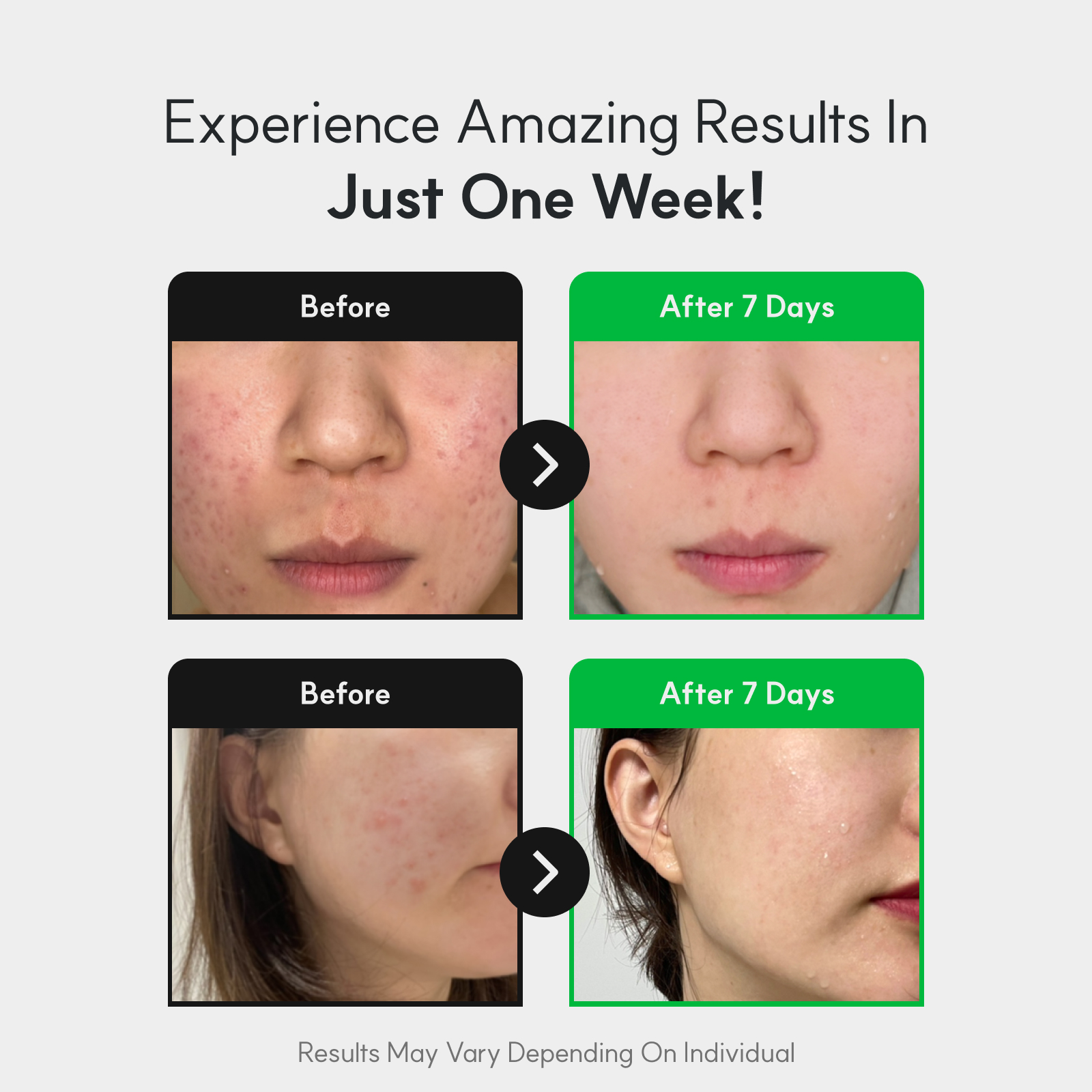 Centella Asiatica Moisturizer Cream 50ml Korean Skincare Face Lotion Ceramide Moisture 5X Soothing Exosome