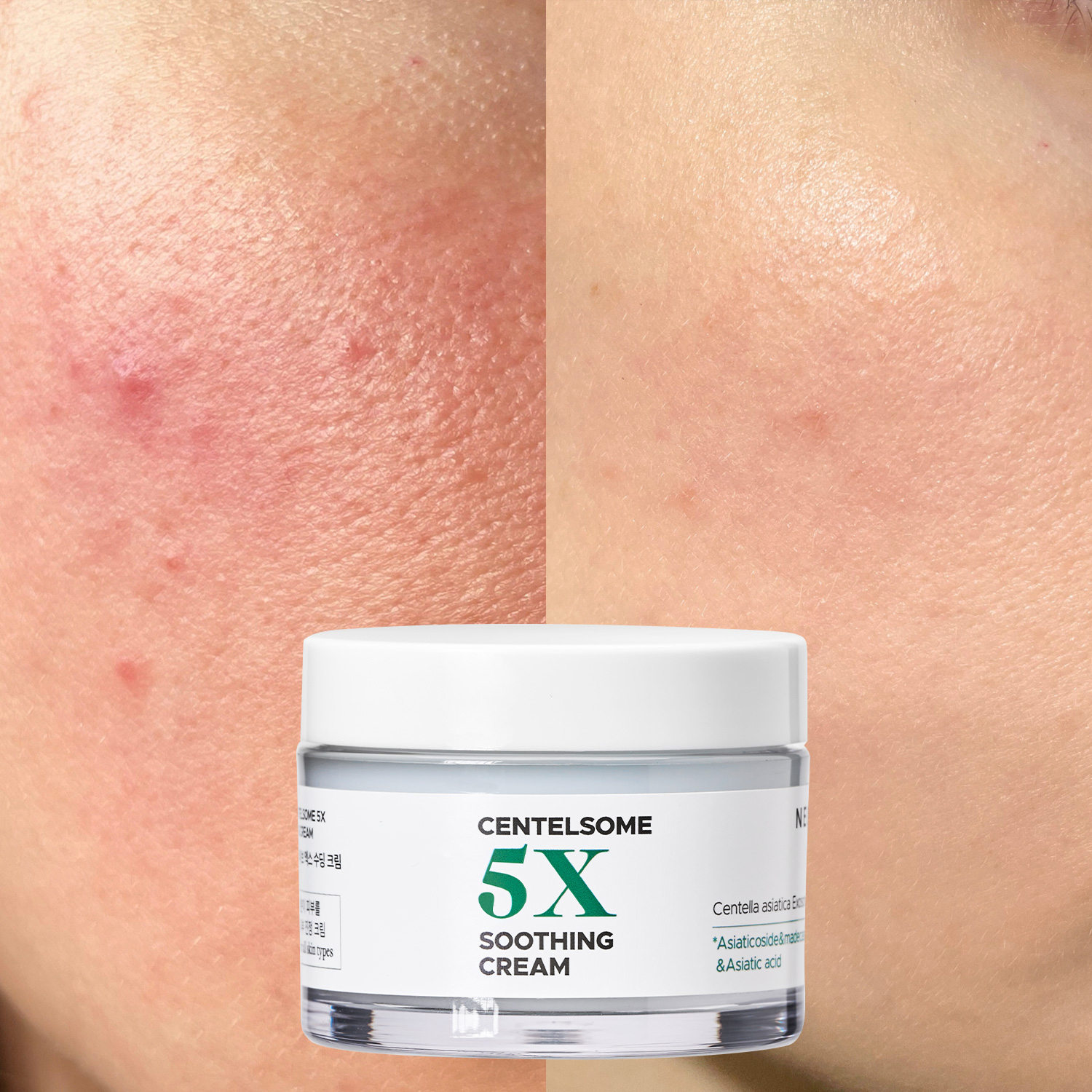 Centella Asiatica Moisturizer Cream 50ml Korean Skincare Face Lotion Ceramide Moisture 5X Soothing Exosome